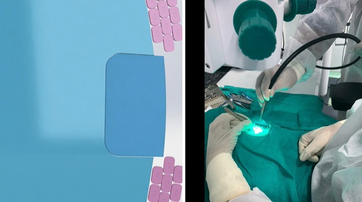 Nucelion Technologies